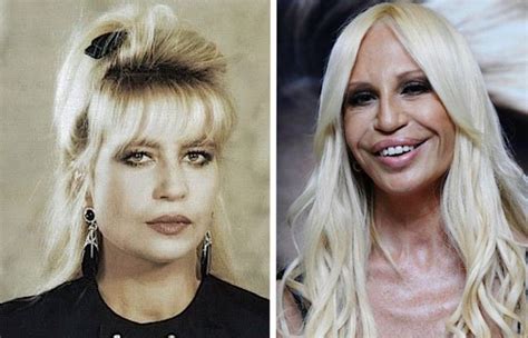 foto donatella versace oggi|donatella versace before and after.